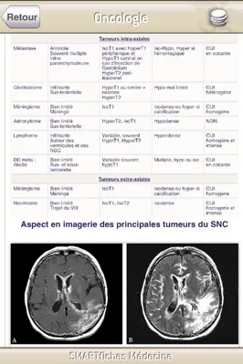 SMARTfiches Oncologie android App screenshot 10