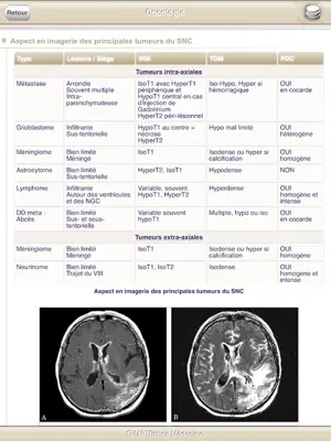 SMARTfiches Oncologie android App screenshot 5